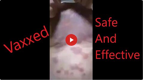 Viewer discretion advised. Extreme covid vax reaction!