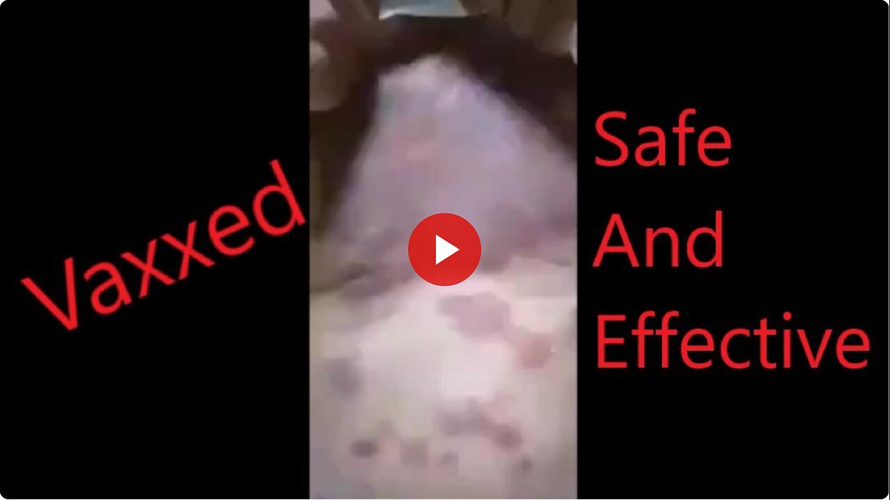 Viewer discretion advised. Extreme covid vax reaction!