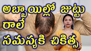 అబ్బాయిల్లో జుట్టు రాలే సమస్యకి చికిత్స Best Treatment For Hair Fall in Men or Androgenetic Alopecia