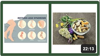 Restless Leg Syndrome - Natural Treatment