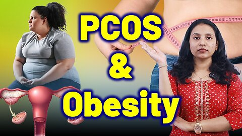 The Link Between PCOS and Weight Gain, Obesity. | Treatment & Cure | Homeopathy, Medicine