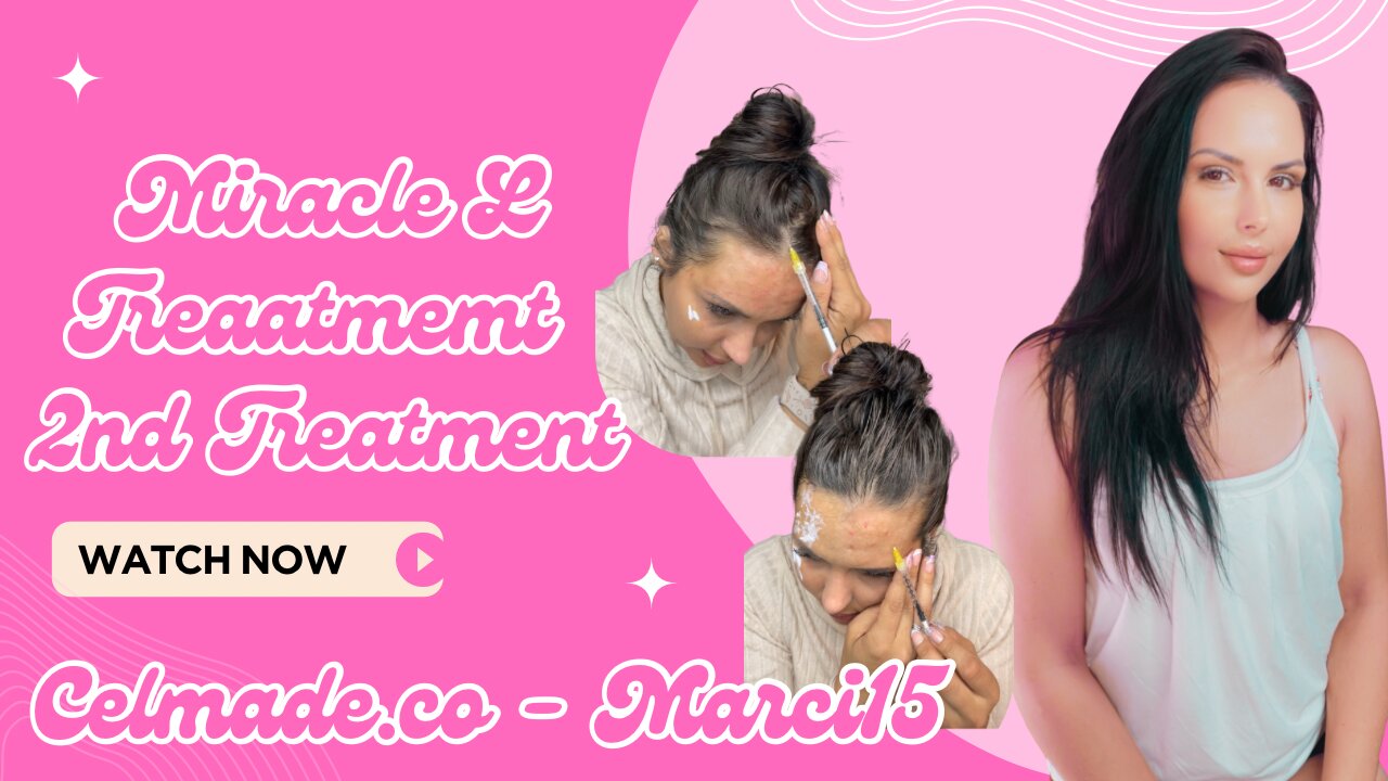 Miracle L upper face & hair treatment 2nd treatment