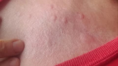 Milyen előnyei vannak annak, ha bedőlsz a biofegyvernek.
