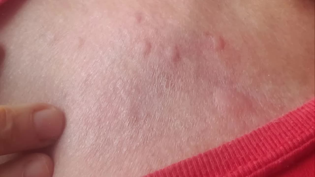 Milyen előnyei vannak annak, ha bedőlsz a biofegyvernek.