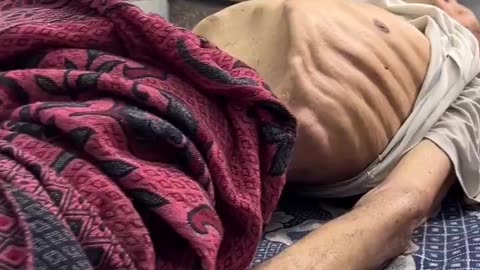 Reduced to skin and bones