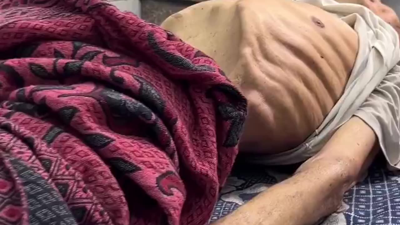 Reduced to skin and bones