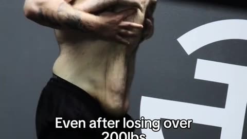 An amazing weight loss
