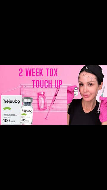 2 Week Tox Touch Up