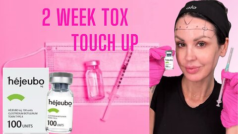 2 Week Tox Touch Up