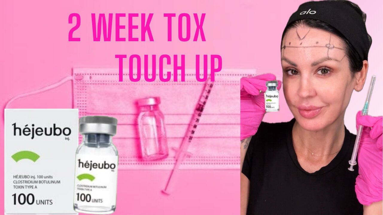 2 Week Tox Touch Up
