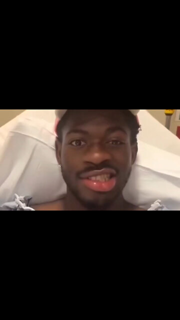 Lil Nas X suffering from Bell's Palsy