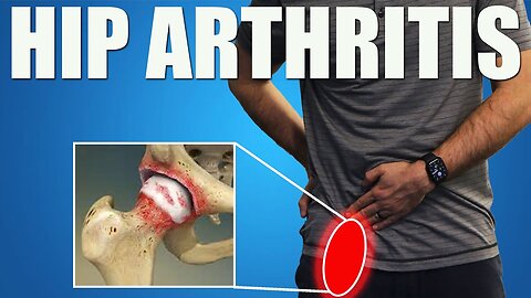 HIP OSTEOARTHRITIS. BEST Exercises, Stretches & Advice for Hip & Groin Pain Relief