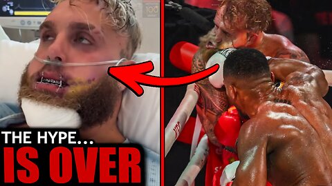 Will Jake Paul Fight Again?👀 "Probably NOT!" Broken Jaw Injury EXPOSED...