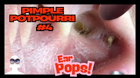 Pimple Potpourri #4