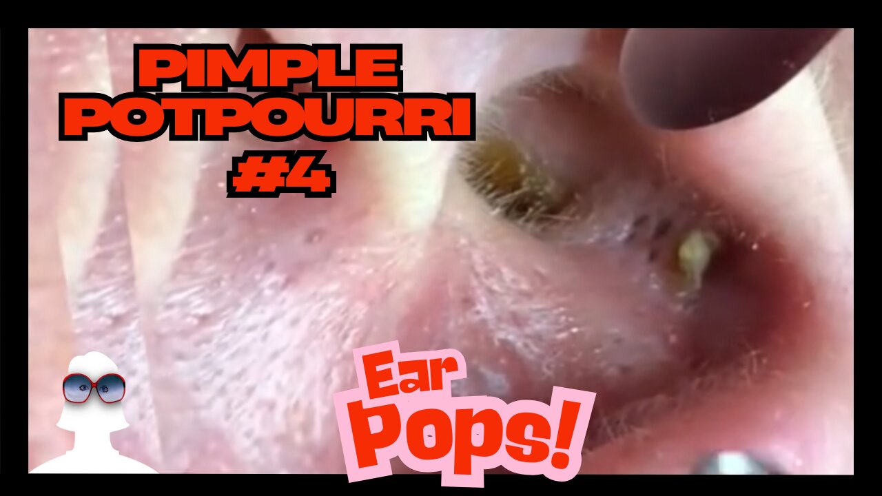 Pimple Potpourri #4