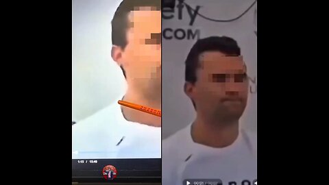 Could this be true about where the bullet impacted Charlie kirks neck?