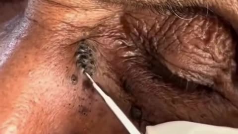 99% of the doctors in the world will never tell you this secret.
