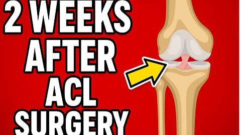 2 Weeks After ACL Surgery