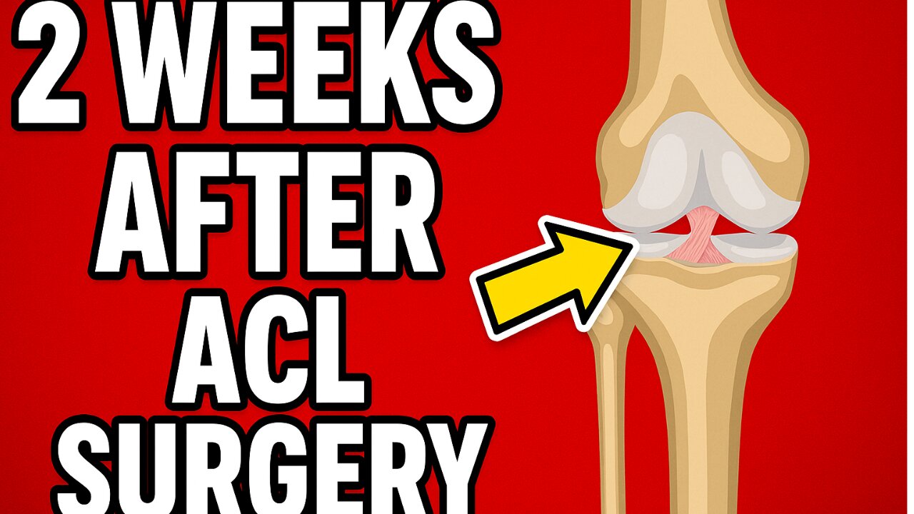 2 Weeks After ACL Surgery