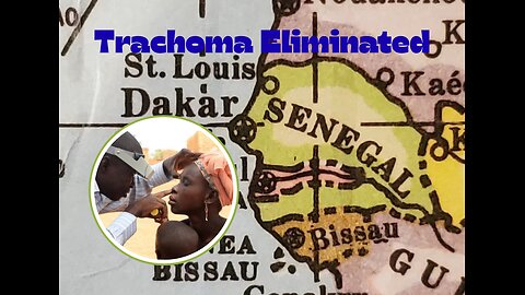 Senegal eliminates trachoma