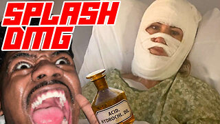 No Arrest Made in Shocking Georgia Acid Attack Despite "Person of Interest"