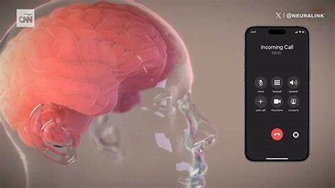 ALERT!!! APPLE TO BEGIN IMPLANTING BRAIN CHIPS IN HUMANS| TO CONNECT THEM WITH THEIR IPHONES!