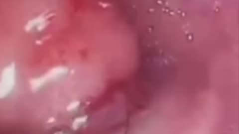 LOOK WHAT’S INSIDE TUMORS!