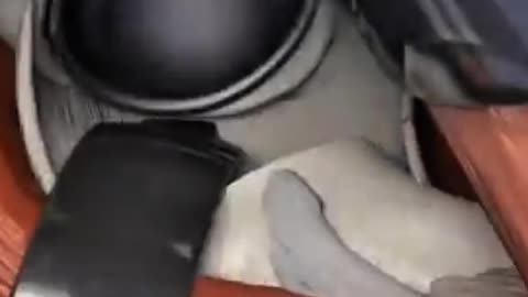 Hip Joint Surgery Treatment for Severe Hip Pain & Damage Medical Education