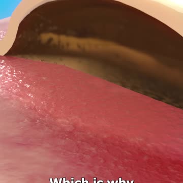 Should_You_Pop_Blisters_From_Burns__🤔