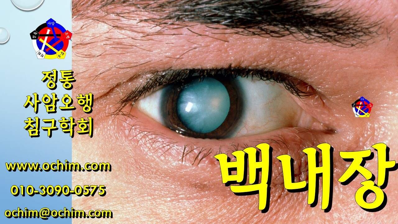 백내장 원인과 치료방법 - 사암오행침, 사암침법, 오행침, 정통사암침