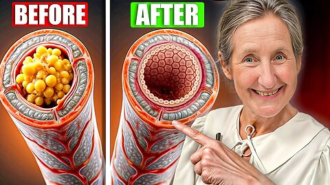 WARNING SENIORS! "Eat These 10 Vegetables To Clean Arteries & Stop Heart Attacks!"