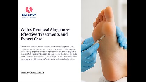 Callus Removal Singapore: Effective Treatments and Expert Care