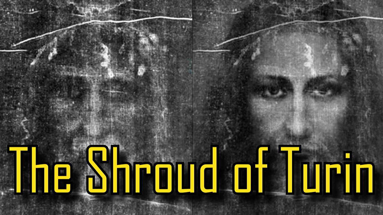 The Shroud of Turin and the death, burial and Resurrection of Jesus