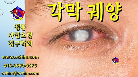 각막 궤양 치료 방법 - 사암오행침, 사암침법, 오행침, 정통사암침