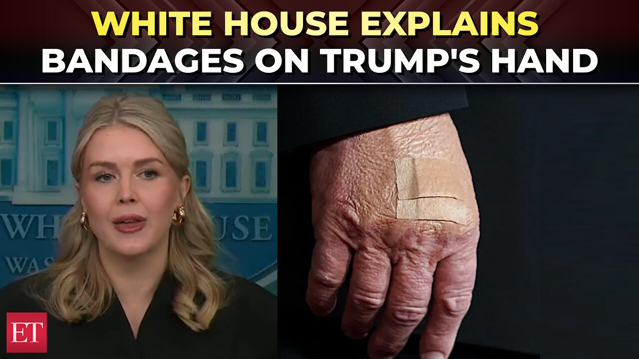 Karoline Leavitt explains Trump’s hand bandages: ‘He’s constantly shaking hands...’