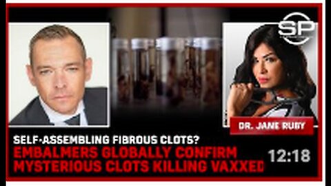 "Global Embalmers Confirm Mysterious, Self-Assembling Fibrous Clots Killing Vaccinated Individuals"