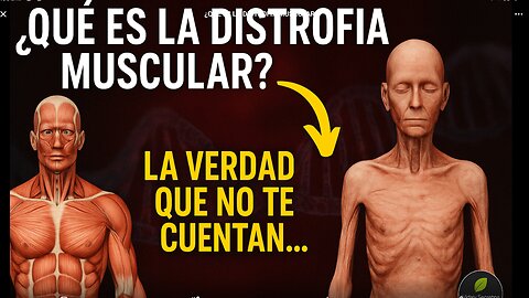 Distrofia Muscular: La Enfermedad Silenciosa Que Destruye el Cuerpo desde los Genes