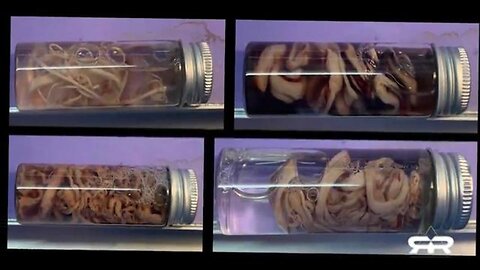 The Nefarious Science Behind the Clot Shots - Greg Reese