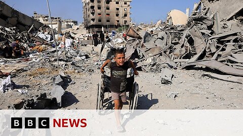 Children in Gaza 'like zombies' because of severe malnutrition, US doctor says ｜ BBC News