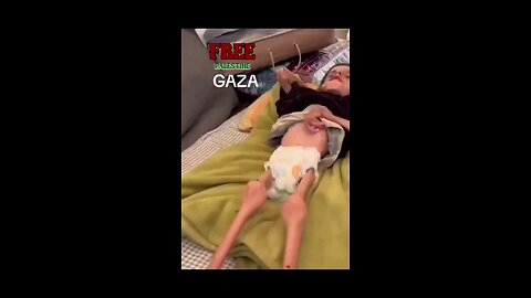 starving Gaza children Isreal did this