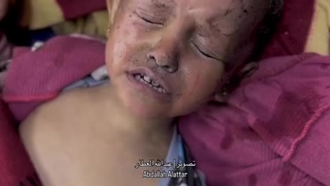 NIÑOS mutilados en Gaza por el regimen SATANICO de ISRAEL +++18🔞🔞🔞