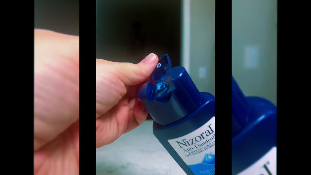 Nizoral Anti-Dandruff Shampoo Review: An Honest Look at the 1% Ketoconazole Treatment