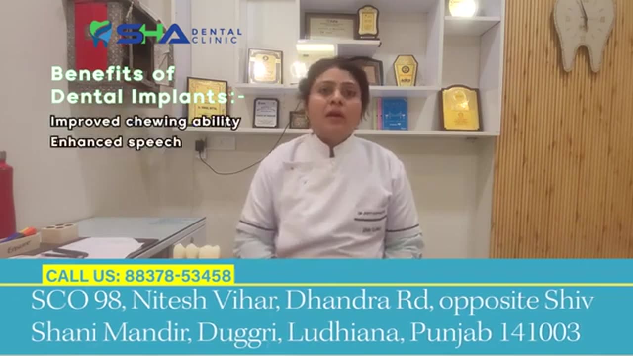 Know more about dental implants by Sha Dental Clinic.