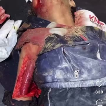 ISRAL GENOCIDE SQUAD SICK BASTARDS ARE MURDERING WHILE WE DINE