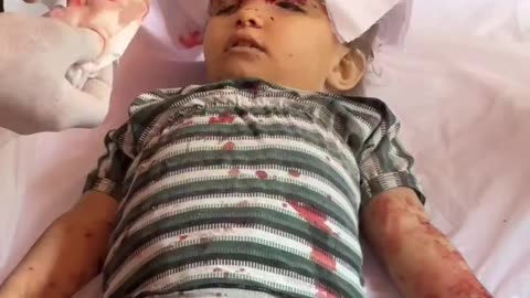 গাযা সিটির যেইতুন এলাকায় ইসরাইলের হামলায় হত্যার শিকার এক ফিলিস্তিনি শিশু