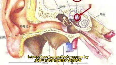 中風針灸 可防跌倒
