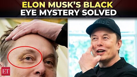 'Go ahead, punch me': Elon Musk blames son 'X' for black eye, jokes about Macron