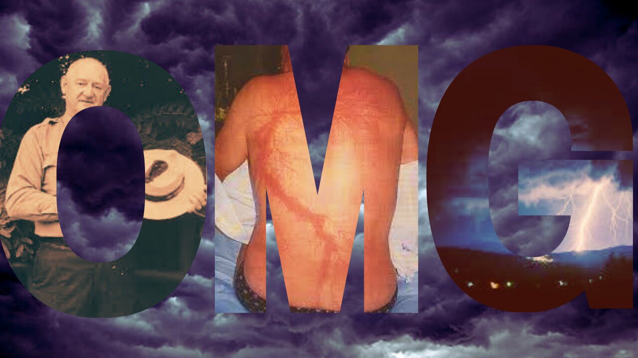 The Man Struck by Lightning 7 Times | MKUSUAL