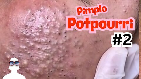 Pimple Potpourri #2