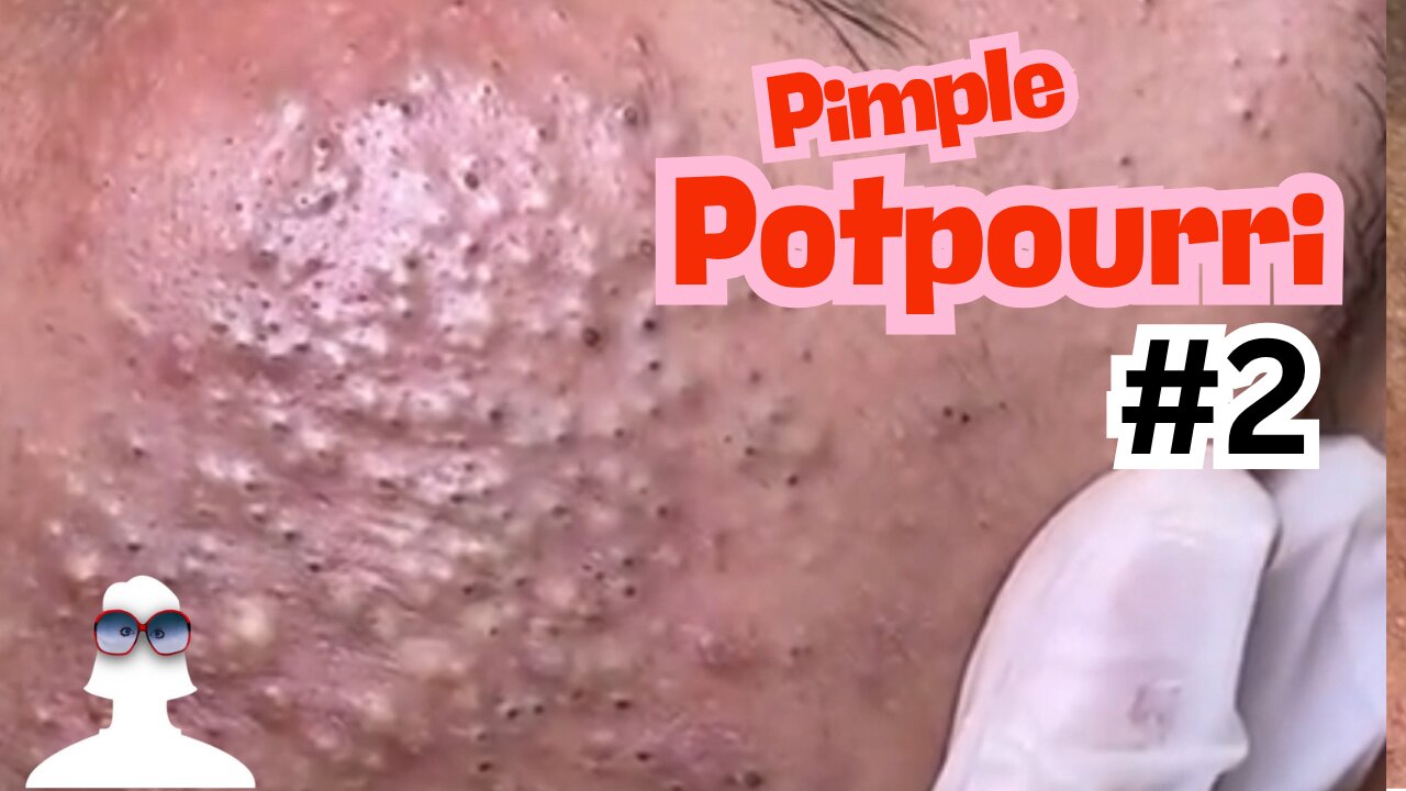 Pimple Potpourri #2